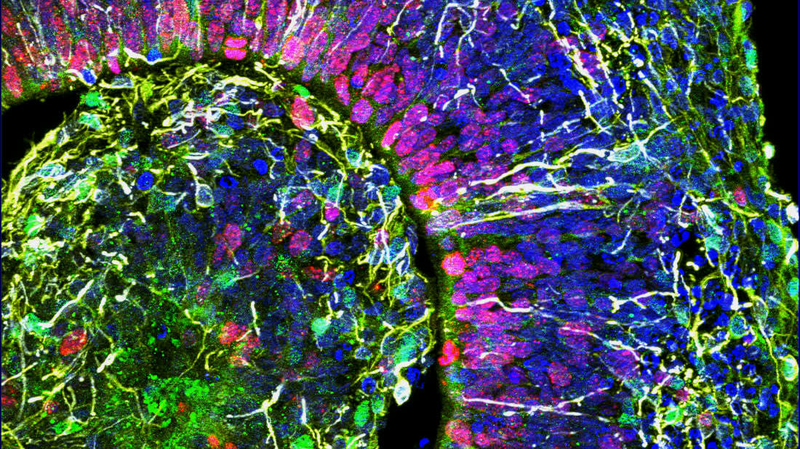 Cross-section of a brain organoid.